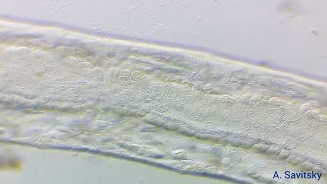 Малощетинковый червь. 250х; 500х. Косое освещение \ Oligochaeta. 250x; 500x. Oblique lighting смотреть онлайн