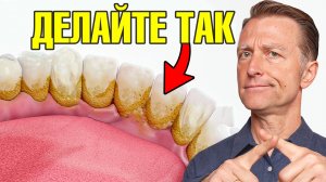 Домашняя зубная паста от зубного камня ? Лучшее средство