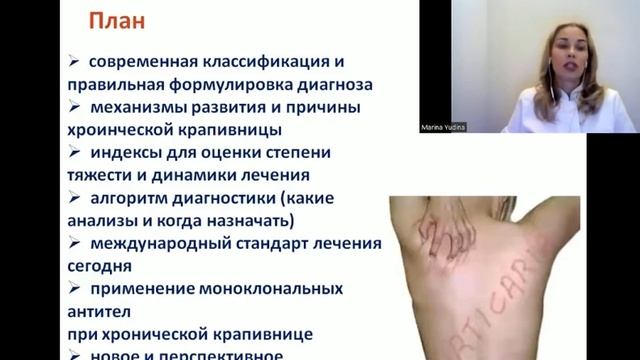 ХРОНИЧЕСКАЯ КРАПИВНИЦА смотреть онлайн