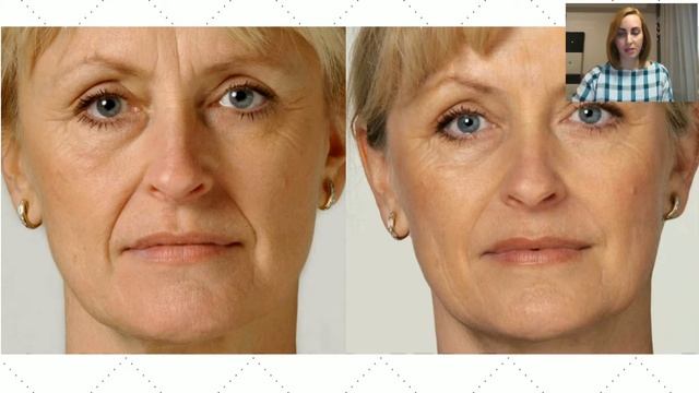 NovAge. Секрет нашей красоты