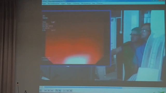 09 М С Бурдюков – Желудочно кишечное кровотечение, возникшее во время цистогастростомии смотреть онлайн