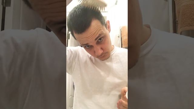 Облысение и Выпадение волос у мужчин. Что делать !? Выпуск #2 смотреть онлайн