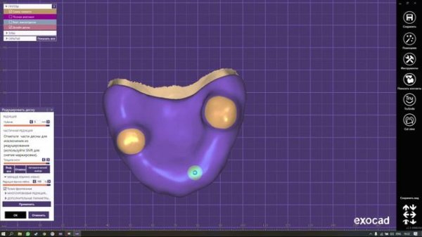 18. Моделирование индивидуальной ложки