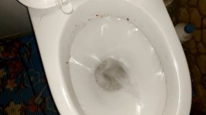 Как прочистить засор в унитазе самому без труда в домашних условиях