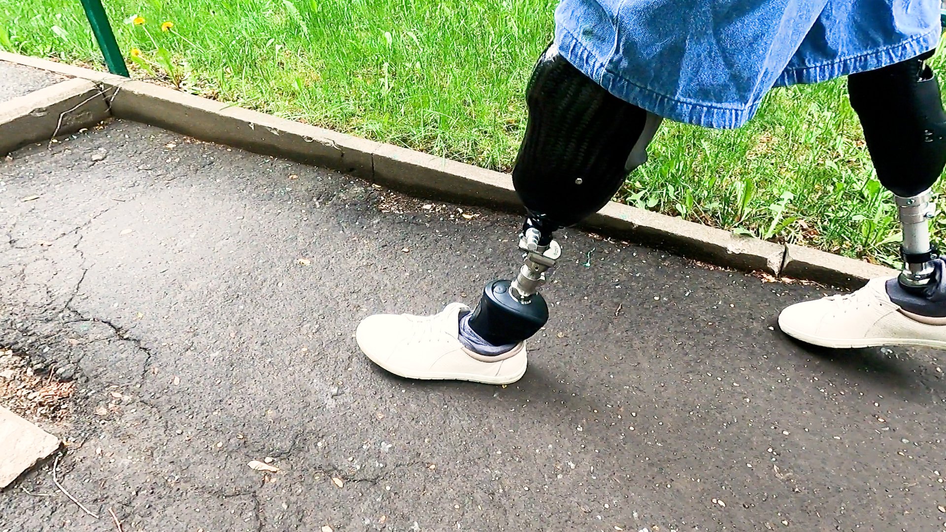 Протезы ног: микропроцессорная стопа смотреть онлайн