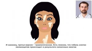 ВИТИЛИГО – ЧТО ЭТО ЗА БОЛЕЗНЬ. ПОЧЕМУ ВОЗНИКАЕТ ВИТИЛИГО? МОЖНО ЛИ ИЗЛЕЧИТЬСЯ ОТ ВИТИЛИГО?