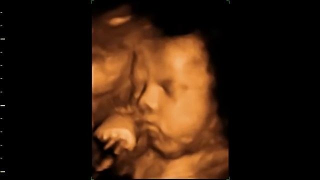 4D-реконструкция плода (36 недель) смотреть онлайн