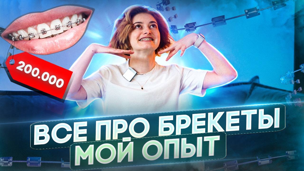 Все что нужно знать о брекетах|Установка|Удаление зубов мудрости
