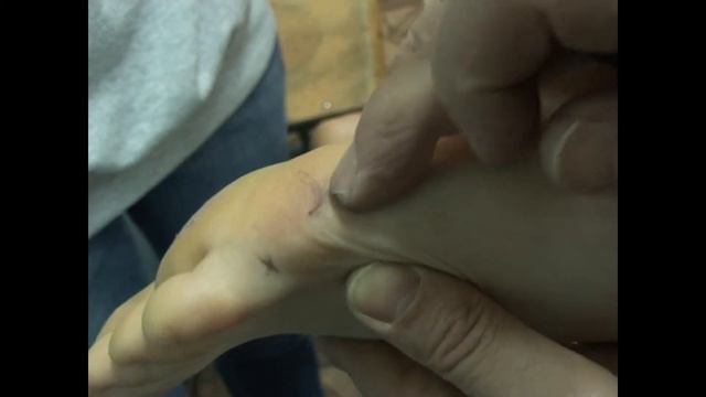 V (3) - канал мочевого пузыря смотреть онлайн