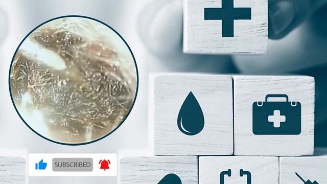 Пожалуйста, очистите ушную серу смотреть онлайн