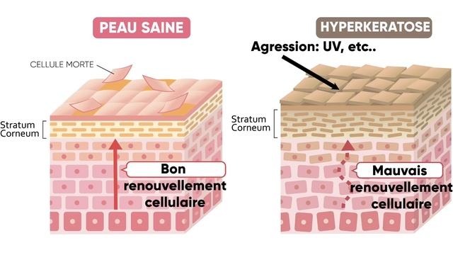 RETINOL: INEFFICACE ET DANGEREUX? 7 conseils смотреть онлайн