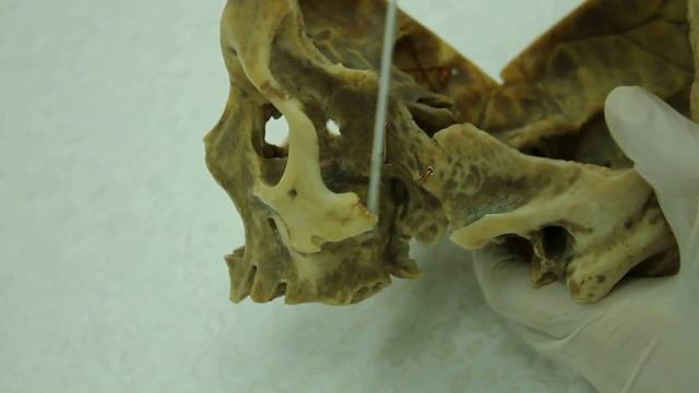 13. Височная ямка - строение