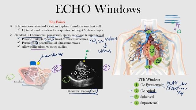 ECHO Windows - ECHO Course l The EKG Guy - www.ekg.md смотреть онлайн