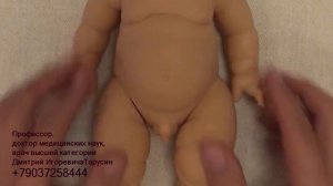 Осмотр новорожденного врачом андрологом урологом