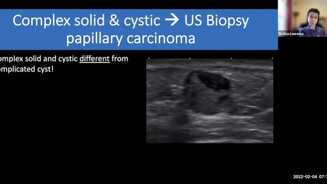 Breast Ultrasound: Review of BI-RADS, Screening, and Cases смотреть онлайн