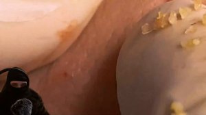 ЧИСТКА лица на ПРЫЩУРИЕ! Черные точки, прыщи ? "Прыщевой путь" (2 серия).