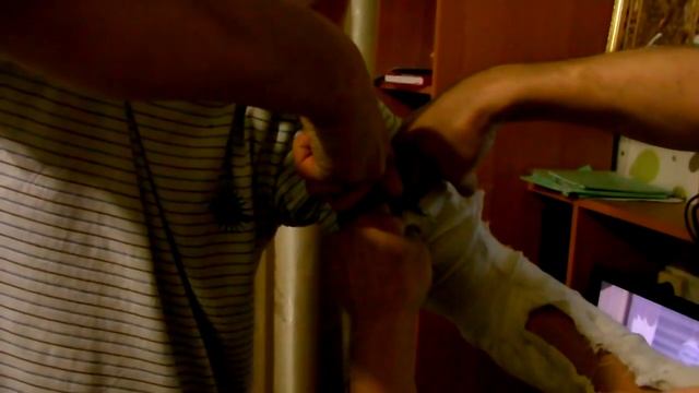 UV: Сняли гипс!!! смотреть онлайн