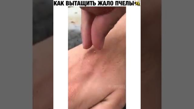 Как вытащить жало пчелы смотреть онлайн
