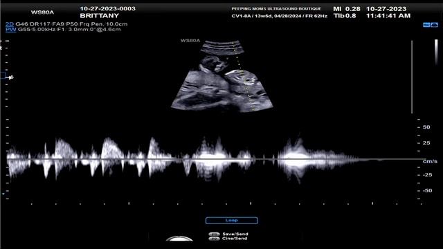 13 WEEK ULTRASOUND FOR BRITTANY смотреть онлайн
