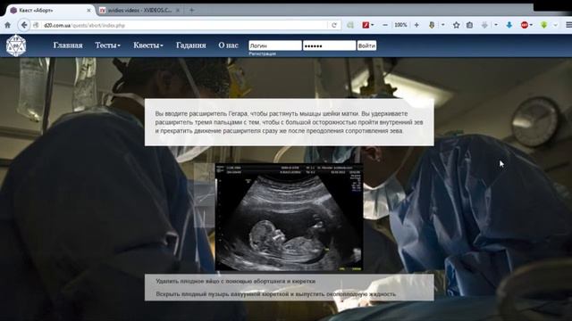 Квест «Аборт» смотреть онлайн