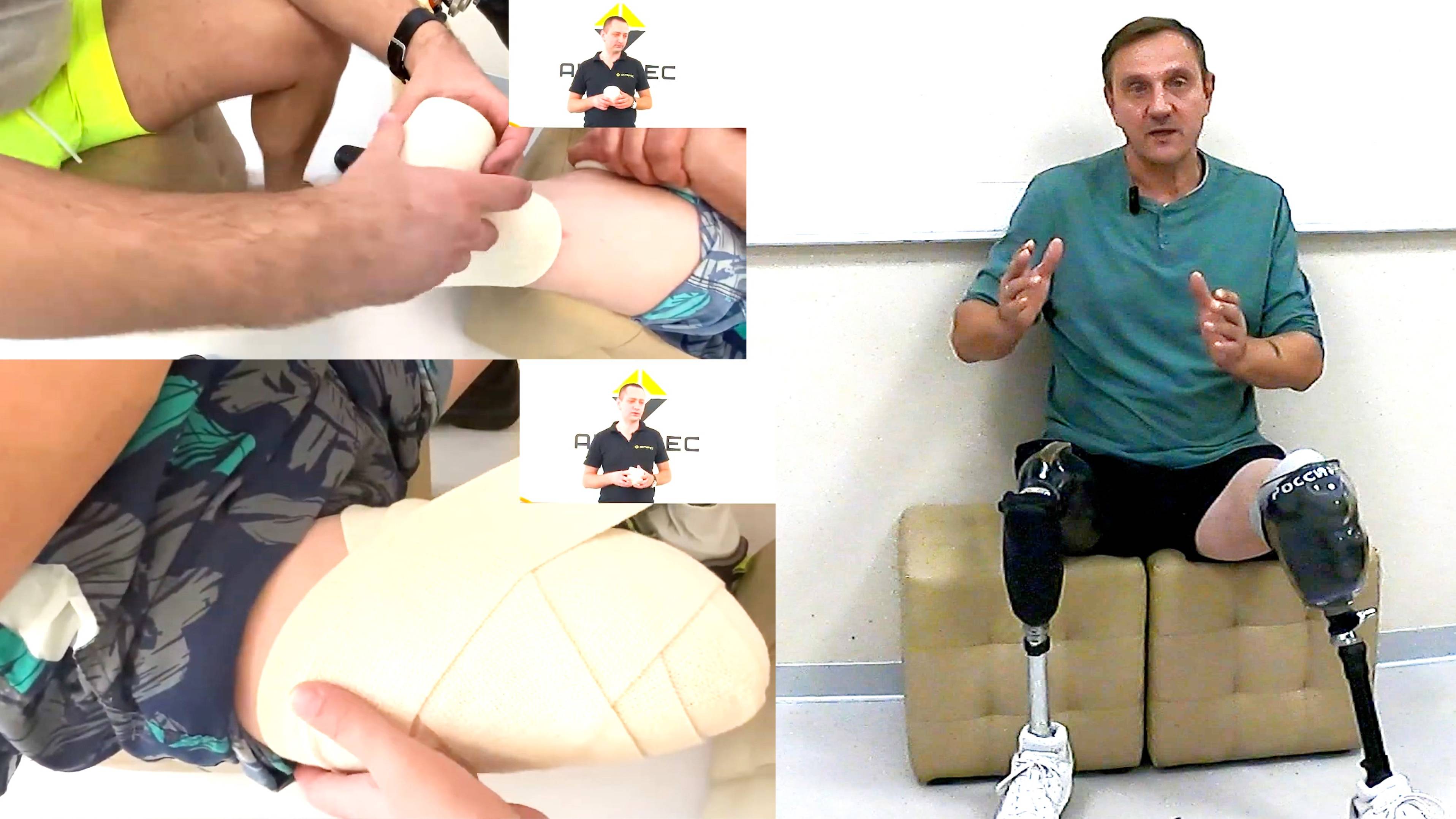 Реабилитация после ампутации ноги: "Подготовка к протезированию" смотреть онлайн