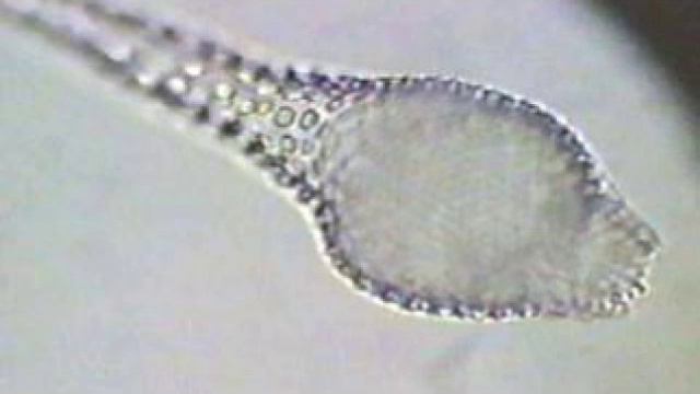 AMOEBOZOANS смотреть онлайн