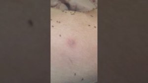 Рожа у свиней