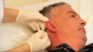 Уход за ушами больного