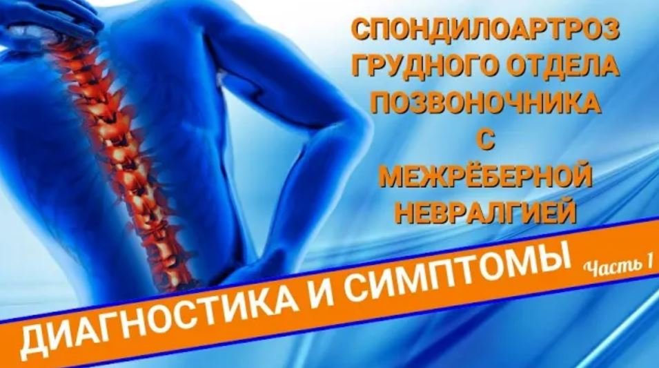СПОНДИЛОАРТРОЗ ГРУДНОГО ОТДЕЛА ПОЗВОНОЧНИКА С МЕЖРЁБЕРНОЙ НЕВРАЛГИЕЙ (Часть 1) смотреть онлайн