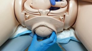 Биомеханизм родов при переднем виде затылочного предлежания.mp4