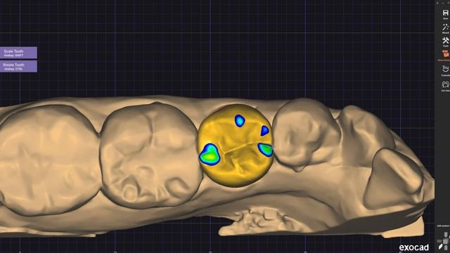 Designing lower 2nd molar with Exocad смотреть онлайн