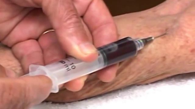 Demonstration Of Auto Hemotherapy