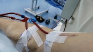 Иду на гемодиализ первый раз в Новом году.