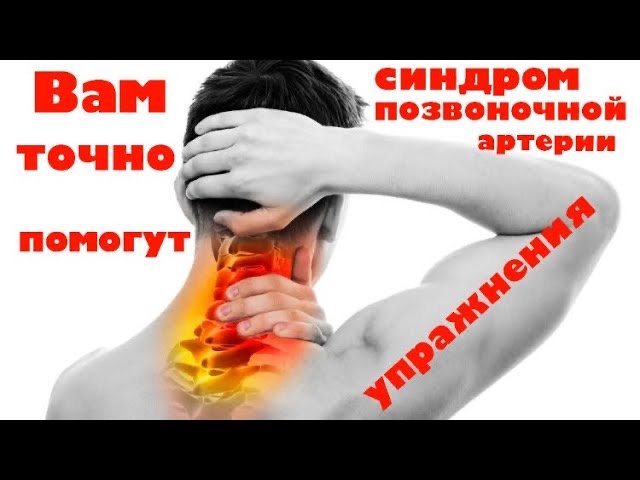 Синдром позвоночной артерии - упражнения, которые Вам помогут! смотреть онлайн