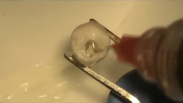 Calcium hydroxide removal смотреть онлайн