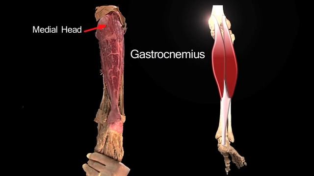 Posterior Leg - Anatomy Tutorial смотреть онлайн