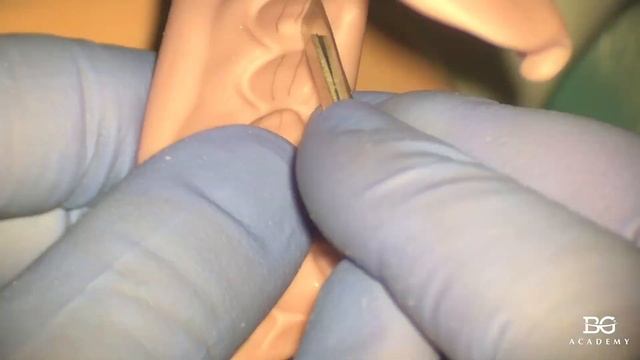 Silicone Index To Control Veneer Preps. Силиконовый ключ.