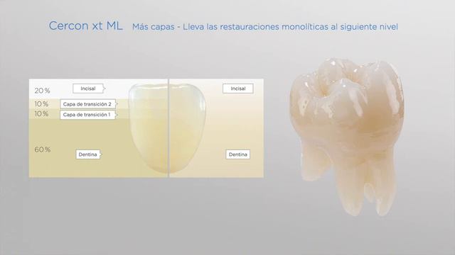 CERCON XT ML Dentsply Sirona смотреть онлайн