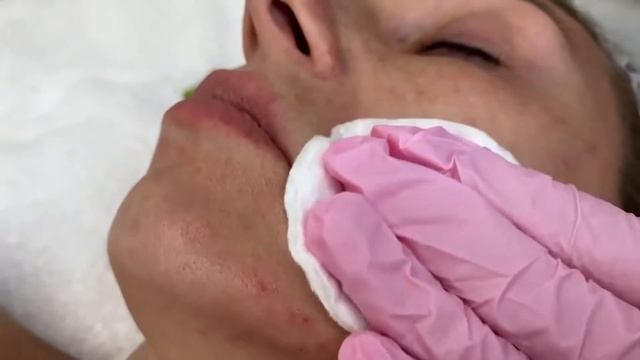 Ep.29 INNO-TDS PEPT HA смотреть онлайн