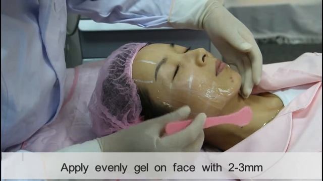 SINCO HIFU wrinkle & face lifting system смотреть онлайн