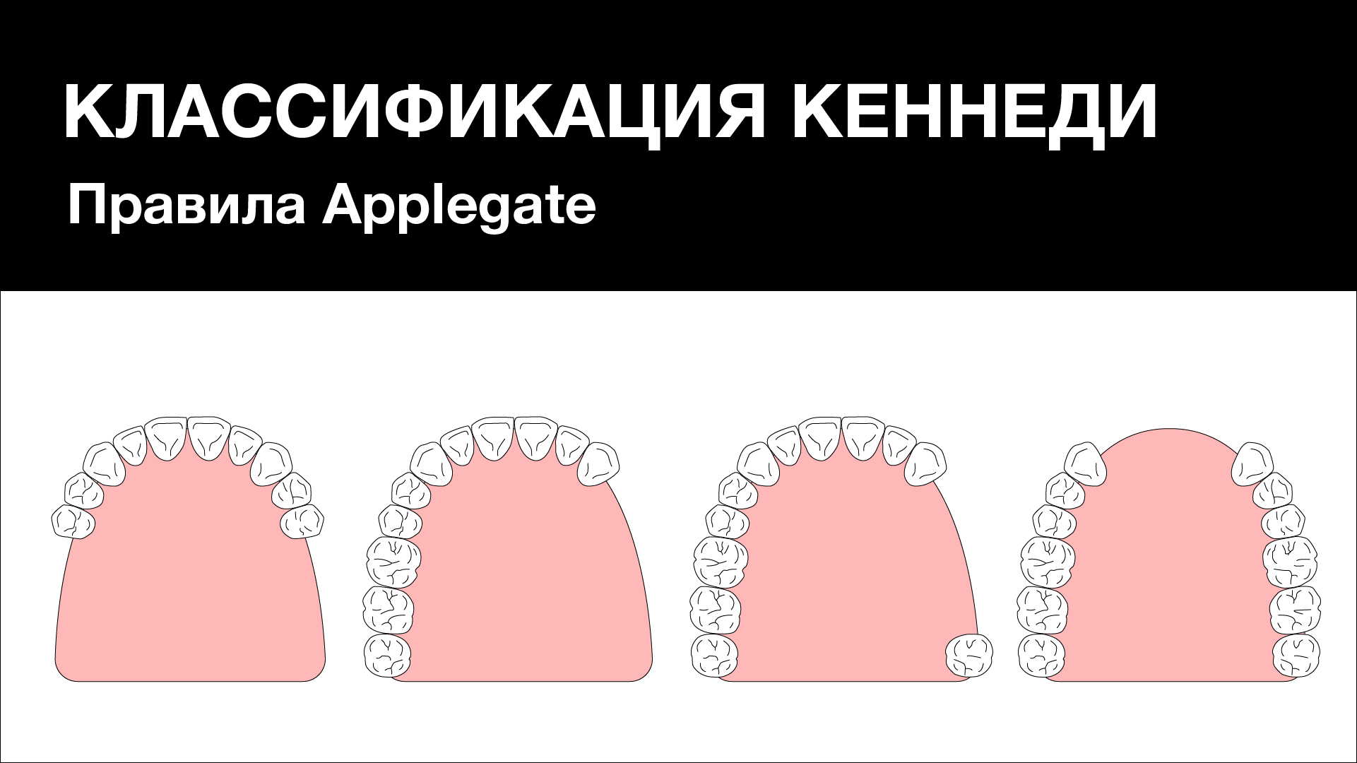 Классификация Кеннеди. Правила Applegate. смотреть онлайн