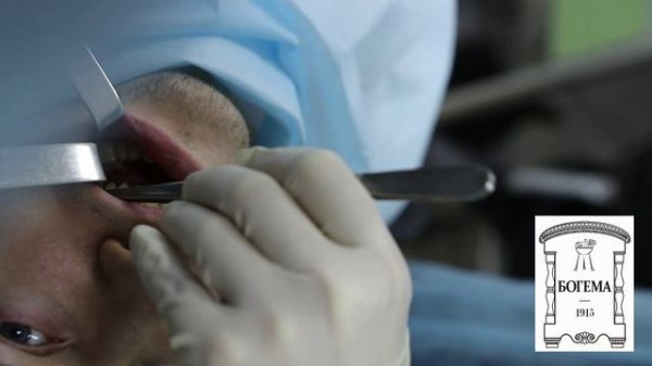 Цена успеха. Удаление комков Биша. Полное видео