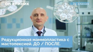 Уменьшение (редукционная маммопластика) + подтяжка груди (мастопексия) до 3 размера в ОН КЛИНИК.