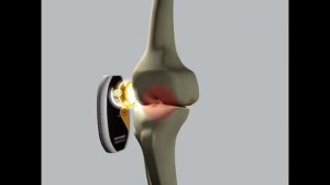 Аппарат магнитотерапии Physiomed  Magcell