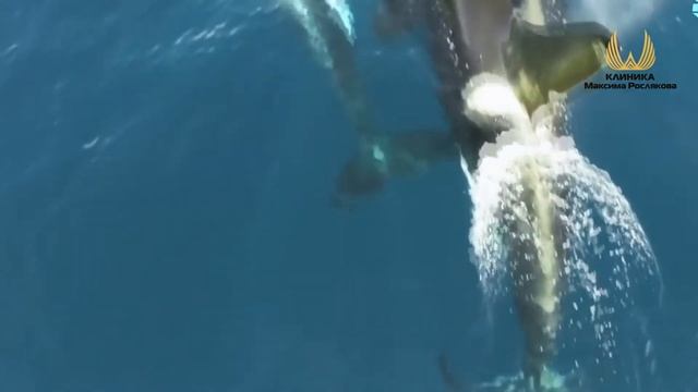 Типы старения. смотреть онлайн