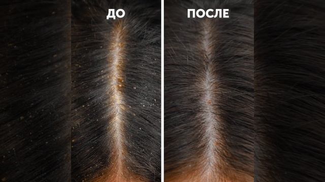 СУПЕР-ЛАЙФХАКИ КРАСОТЫ || КАК УХАЖИВАТЬ ЗА ПОДМЫШКАМИ смотреть онлайн
