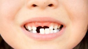 МОЛОЧНЫЕ ЗУБЫ ВАЖНО ЗНАТЬ | 7 главных заблуждений о смене молочных зубов