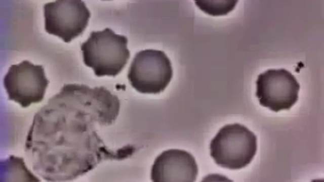 Как лейкоцит съедает вирус смотреть онлайн