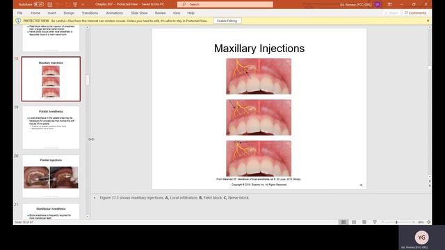 Chapter 37 lecture Part 1 Anesthesia and Pain Control смотреть онлайн
