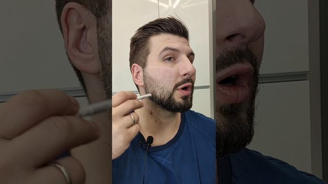 Требуется ли вам коррекция филлерами #советыкосметолога #ответынавопросы смотреть онлайн